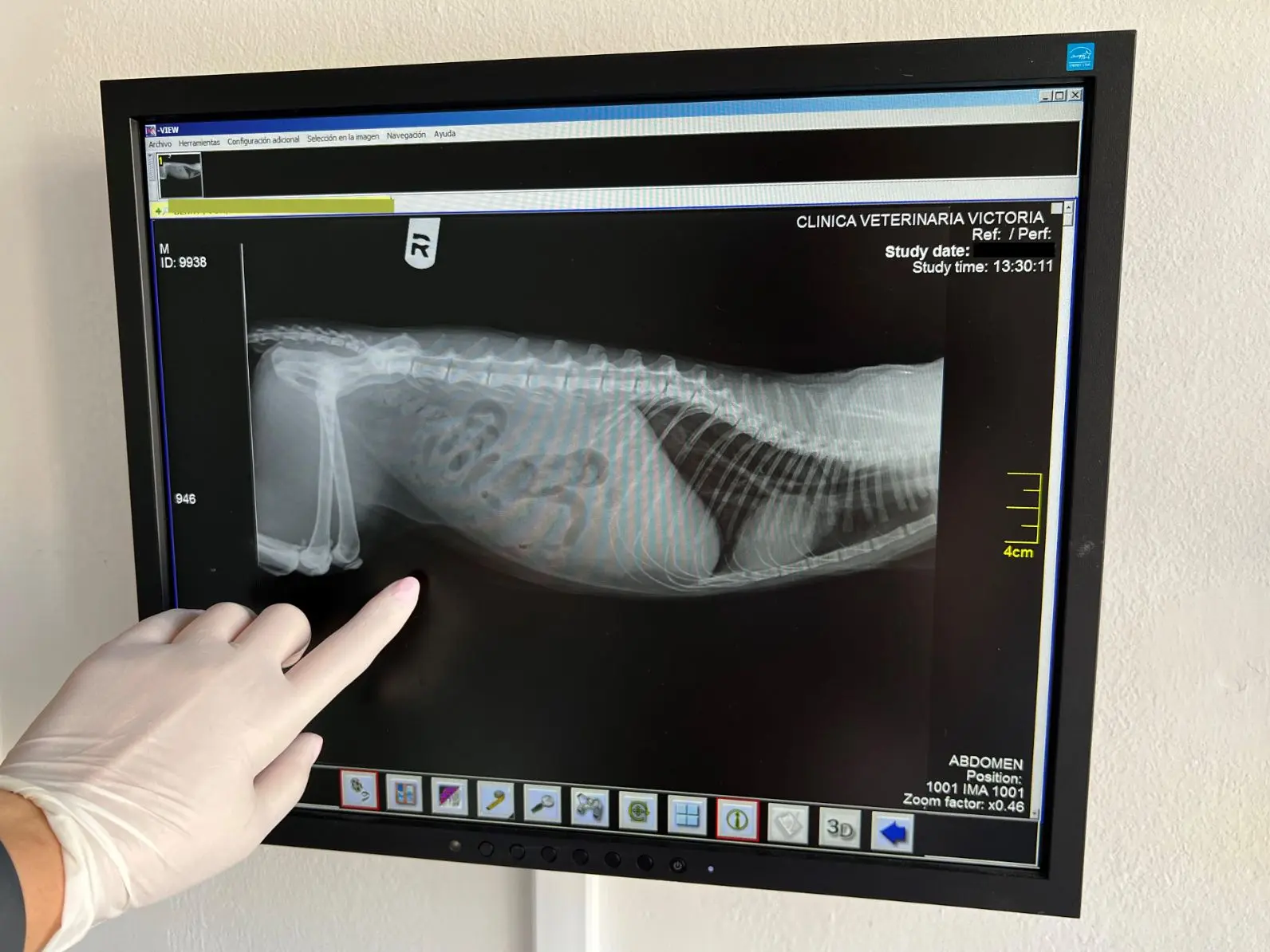 Radiología digital
